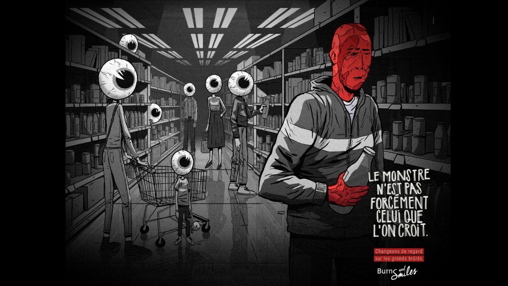 À travers une campagne d’affichage l’association Burns & Smiles et TBWAParis veulent faire réfléchir, sur le regard que les grands brûlés doivent affronter en société. Illustration, d'un grand brulé avec des yeux qui le regardent de partout