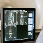 Médecin devant des radiographies